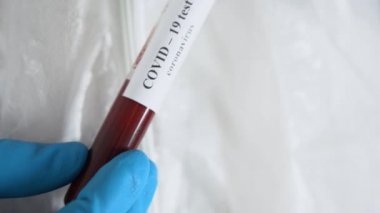 Tanımlanamayan sıhhiyeci beyaz koruyucu elbise giyiyor, mavi lateks eldivenler giyiyor, COVID-19 virüsü tehdidi altında kırmızı kanın negatif analiziyle test tüpü tutuyor, görüş alanını kapatıyor..