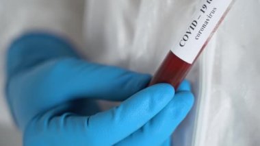 Bulaşıcı hastalıklar doktoru beyaz tıbbi elbise giyer, koruyucu mavi tek kullanımlık eldivenler giyer, elinde tutar ve kırmızı kalın kanla elinde döner.