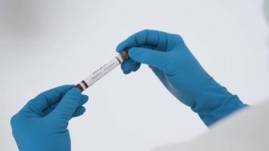 Tanımlanamayan sıhhiyeci mavi lateks eldiven giyer, üzerinde kırmızı kan bulunan test tüpü taşır ve beyaz arka planda 2019-nCoV corona virüsü için pozitif analiz yapılır. Üst görünüm kapat.