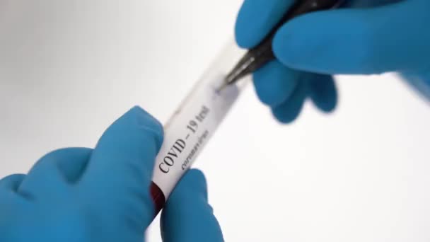 Hands Scientist Man Medical Blue Gloves Hold Glass Tube Blood — Stock Video