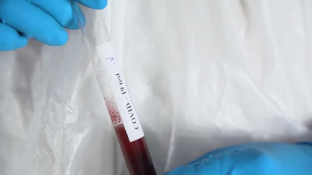 Ein Wissenschaftler Weißen Medizinischen Antibakterienschutzanzug Mit Blauen Gummihandschuhen Hält Ein — Stockvideo