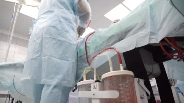 吸脂手术用脂肪收集容器 — 图库视频影像