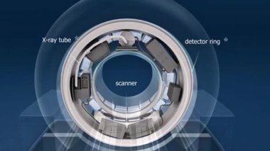 3D animation displaying PET-CT device, highlighting scanner design, imaging technology, and patient examination process.