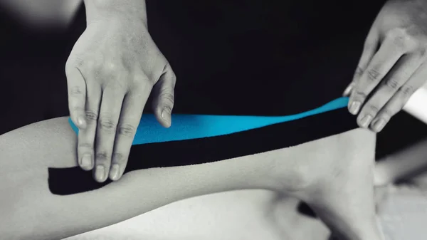 キネシオロジーのメスの患者に青いテープでテーピング治療の黒と白のイメージは アキレス腱を負傷しました スポーツ傷害キネシオ治療 — ストック写真