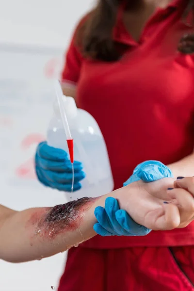 Ehbo Opleiding Burn Schade Ehbo Cursus — Stockfoto