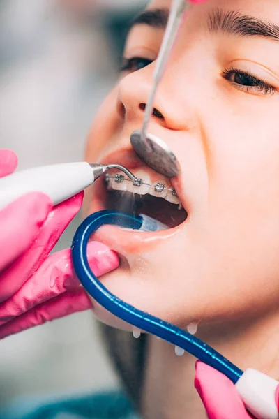 Kieferorthopädin Putzt Mädchenzähne Mit Zahnspange — Stockfoto