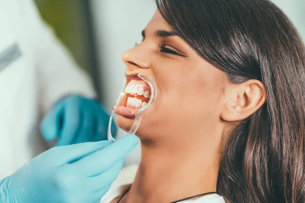 Mujer Joven Que Tiene Dientes Dental Procedimiento Blanqueamiento — Foto de Stock