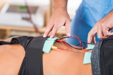 Elektriksel stimülasyon fizik tedavide. Kadın bir atletin alt sırt kasları üzerinde konumlandırılmış elektrotlar