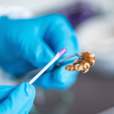 Mikrobiyolog analizi, mühendislerimizin kalite laboratuvar meyvelerin