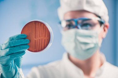Petri dish, teftiş mikrobiyolog bakteri büyüme gözlemleyerek