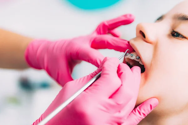 Ортодонт Фіксує Дівчачі Зубні Брекети — стокове фото