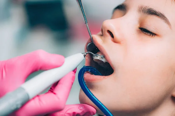 Orthodontist Schoonmaken Meisjes Tanden Met Tandheelkundige Bretels — Stockfoto