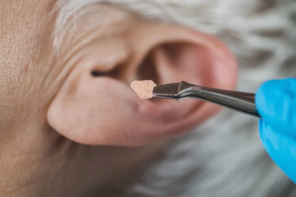 Auriculoterapia Tratamento Auricular Ouvido Humano Perto Mão Terapeuta Aplicando Adesivo — Fotografia de Stock