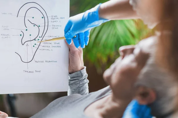 Patiënt Leren Oorpunten Auriculotherapie Behandeling — Stockfoto