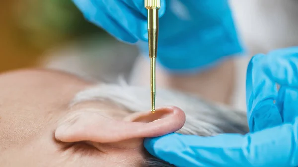 Auriculoterapia Tratamento Auricular Ouvido Humano Com Massagem Flexível Caneta Orelha — Fotografia de Stock