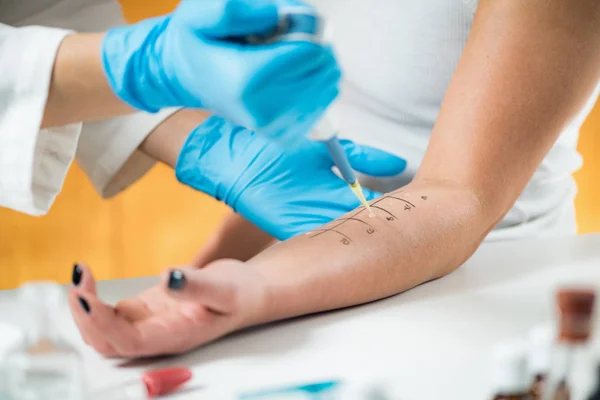 Allergy Skin Prick Tests Womans Arm — Stock Photo, Image