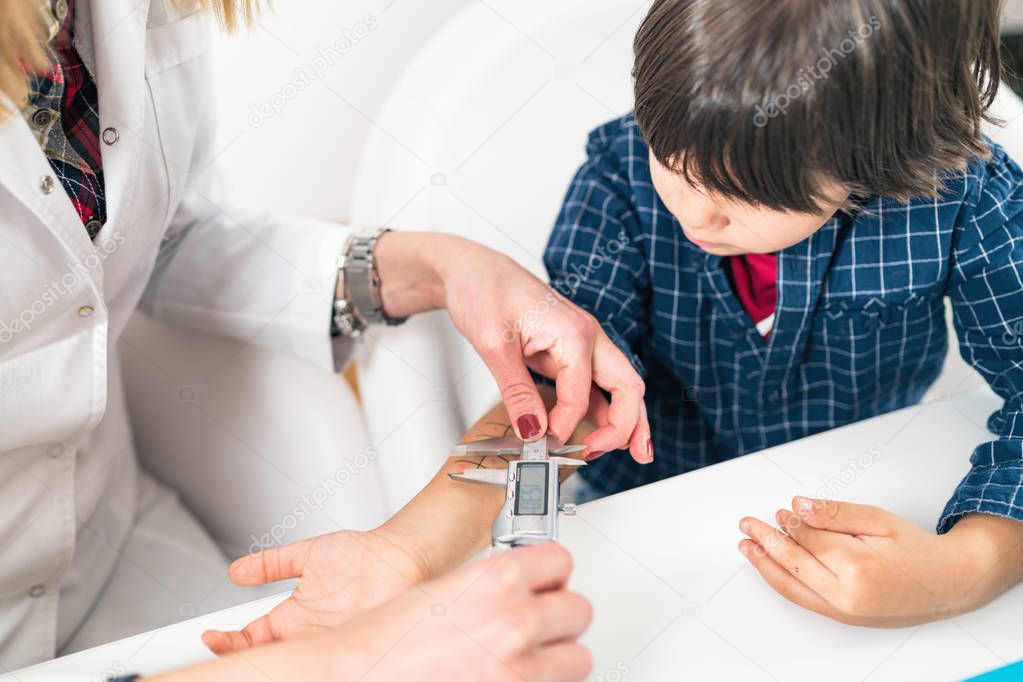 Immunology Doctor Measuring Allergy Reaction of Patient, Little Boy