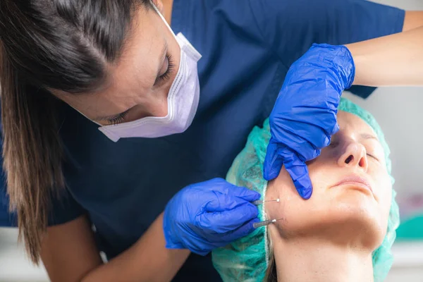 Gesichtslifting Mesotherapie Behandlung Mit Meso Fäden — Stockfoto