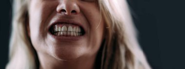 Travma sonrası stres bozukluğu ya da travma sonrası stres bozukluğu. Akıl sağlığı yerinde olmayan bir kadın..