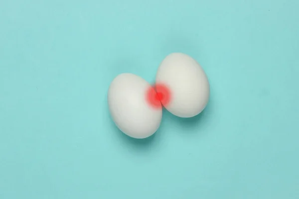 Prostatite Inflamação Próstata Foto Alegórica Ovos Galinha Com Inflamação Vermelha — Fotografia de Stock
