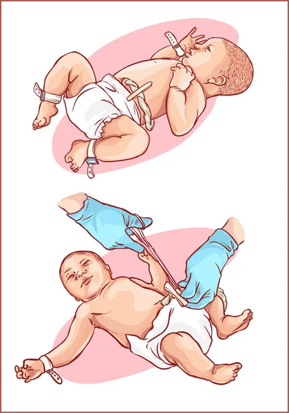 Corte Del Cordón Umbilical Bebé Recién Nacido — Vector de stock