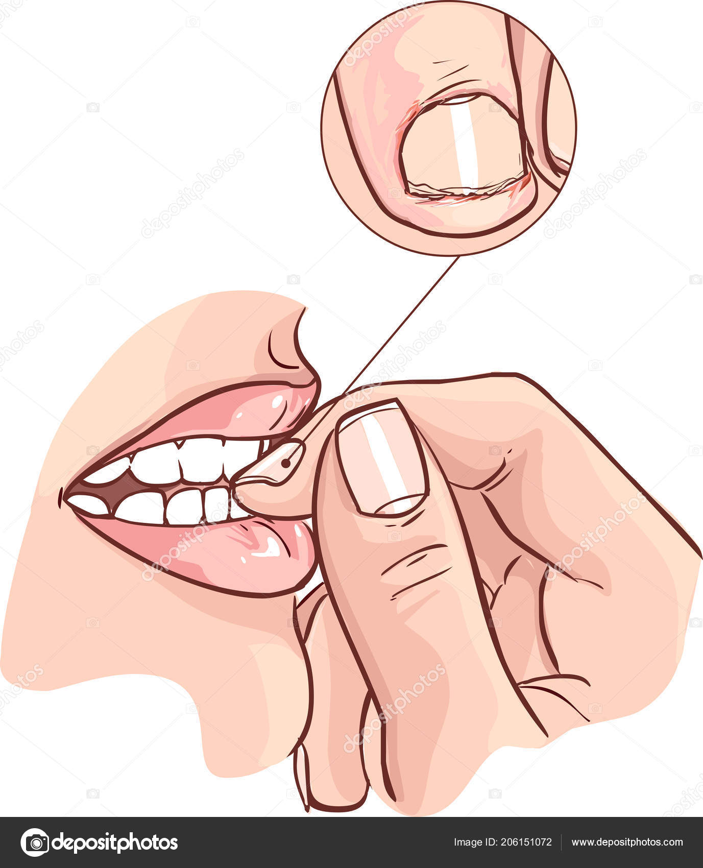 Nail biting Vector Art Stock Images | Depositphotos Nail biting Vector Art Stock Images | Depositphotos