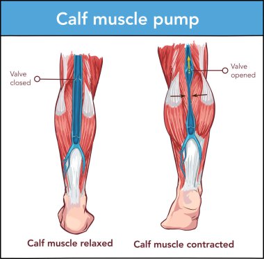  vector illustration of a calf muscle pump clipart