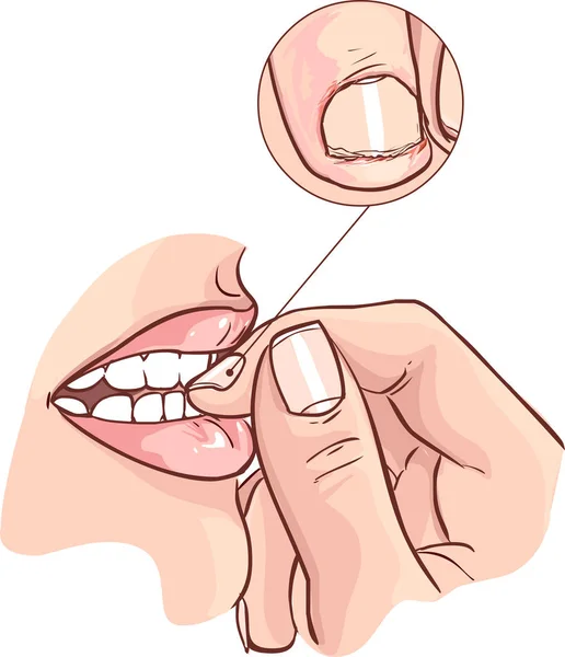 Close View Woman Biting Nails — Stock Vector