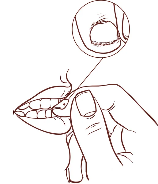 39 Biting nails Vector Images, Biting nails Illustrations Depositphotos