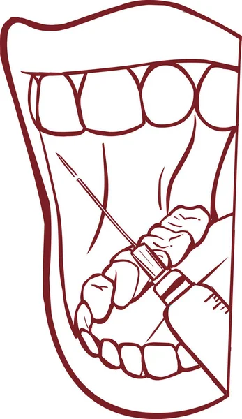 Anestesia Regional Oral Maxilofacial — Vector de stock