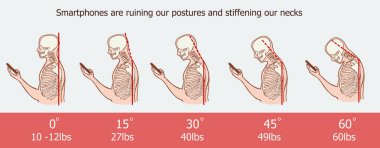The bad smartphone postures,the angle of bending head related to the pressure on the spine, vector flat cartoon illustration. Man with phone with neck pain isolated on white background stock vector clipart