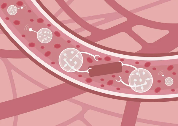 Toekomst Van Geneeskunde Nanobots Actie Nanorobots Opsporen Elimineren Van Trombus — Stockvector