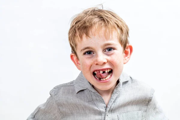 Gargalhando menino com sardas sendo irritado por seu dente desaparecido — Fotografia de Stock