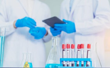 Bilim adamı covid-19 virüs kimya araştırması biyoteknoloji antikor örneği laboratuvarı virüse karşı aşı üretiyor. Bilim adamı mikroskoba bakıyor, bilim test tüpü kimya laboratuvarını analiz ediyor.