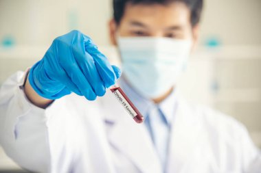 Bilim adamı covid-19 virüs kimya araştırması biyoteknoloji antikor örneği laboratuvarı virüse karşı aşı üretiyor. Bilim adamı mikroskoba bakıyor, bilim test tüpü kimya laboratuvarını analiz ediyor.