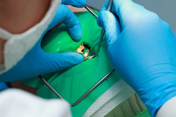 Dentista Muy Cuidadosamente Comprobar Reparar Diente Joven Paciente — Foto de Stock