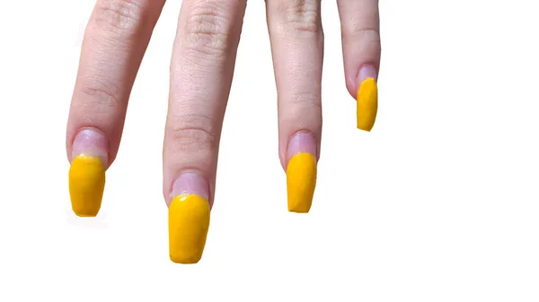 Manucure Affreuse Extension Des Ongles Les Ongles Envahis Sont Jaunes — Photo