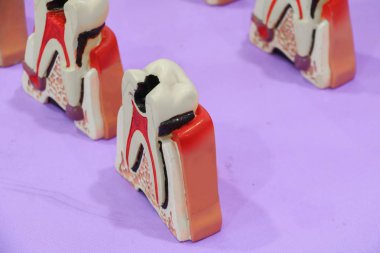 Bir tablo üzerinde diş diş modeli