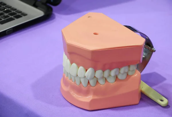 テーブルの上の歯の歯科モデル — ストック写真