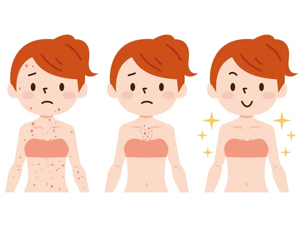 Body with skin problems. Before, after. Vector illustration. — Stock Vector