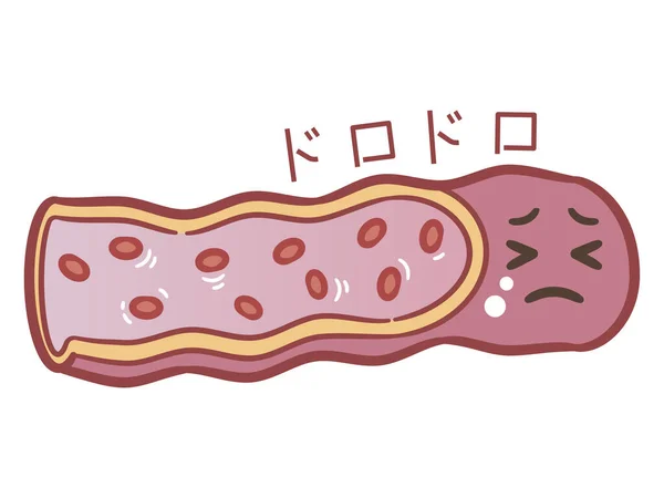 不健康な血管かわいい漫画のキャラクター 体の解剖学的要素 健康医学的徴候 内部器官 白い背景ベクトル図に隔離された人体生理学 — ストックベクタ