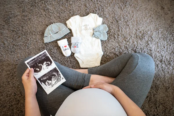 Kobieta Ciąży Czuje Się Szczęśliwa Zbliżenie Kobiety Ciąży Usg Brzuchu — Zdjęcie stockowe