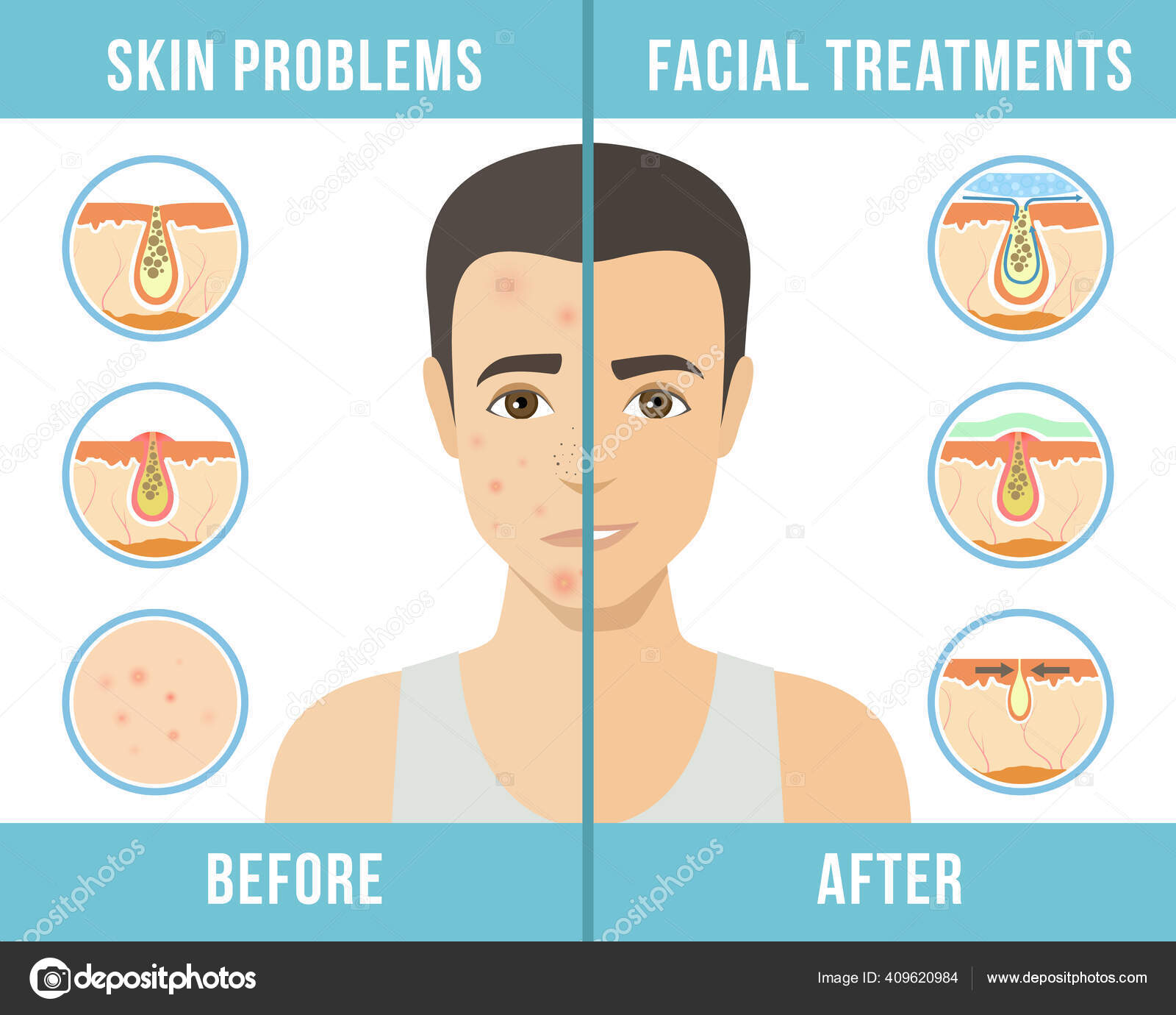 men skin care acne