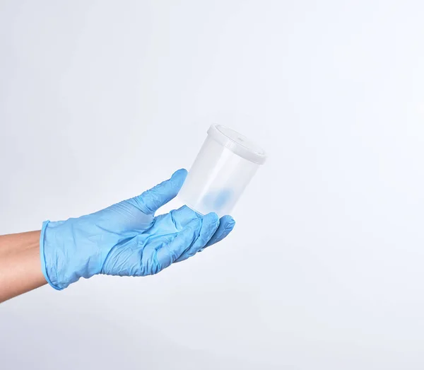 Ruka v modré sterilní rukavice drží plastový kontejner — Stock fotografie