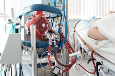 çalışma ecmo makine yoğun bakım bölümü