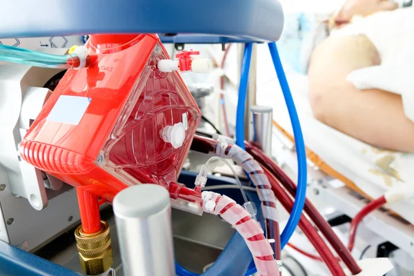 ECMO makine yoğun bakım bölümünde, closeup oxygenator çalışan