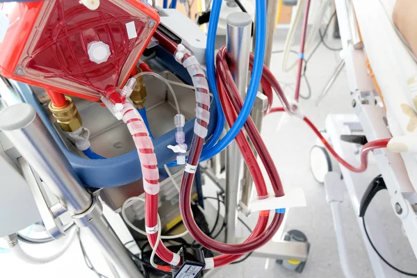 Macchina Ecmo Funzionante Nel Reparto Terapia Intensiva — Foto Stock