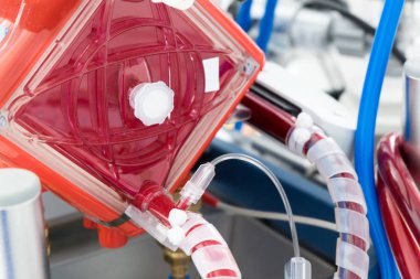 ECMO makine yoğun bakım bölümünde, closeup oxygenator çalışan