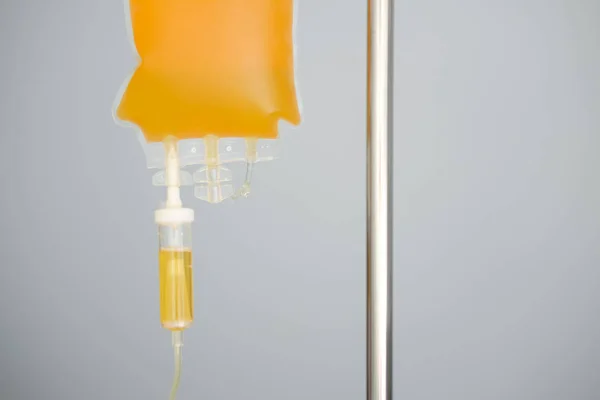 Transfusion Von Frisch Gefrorenem Plazma Ffp Tasche Auf Ständer Medizin — Stockfoto