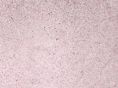 mikroskop görüntü cross-match testi sırasında kan